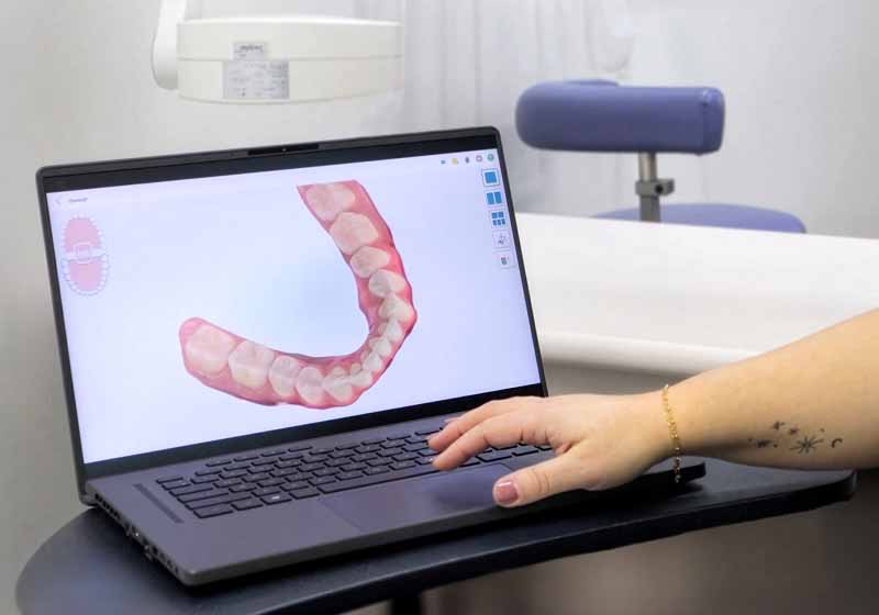 3D digital X-rays of a smile