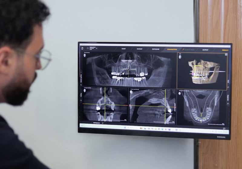 reviewing dental X-rays