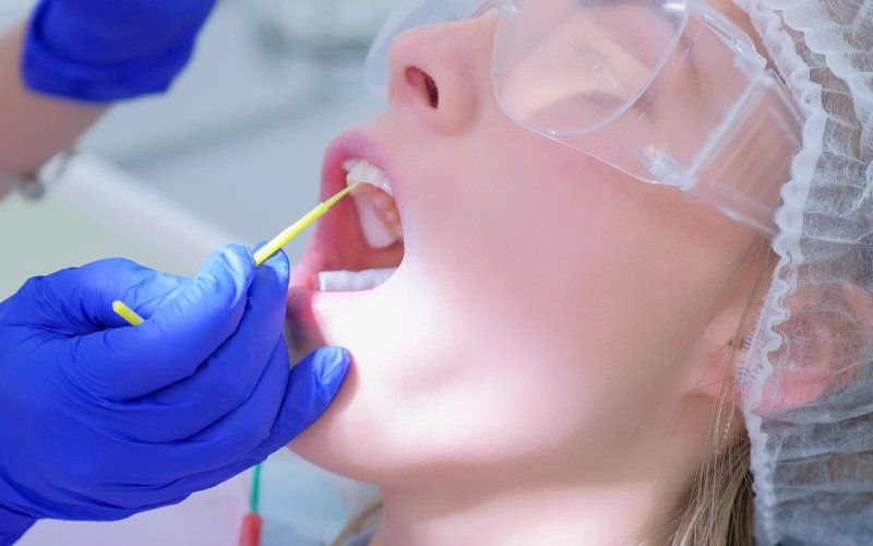 dentist make fluoridation of teeth after ultrasonic cleaning for young woman